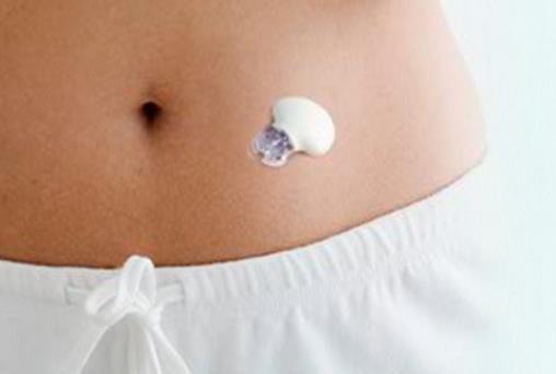 SÜREKLİ GLUKOZ ÖLÇÜM SİSTEMLERİ Continuous Glucose Monitoring System (CGMS) -