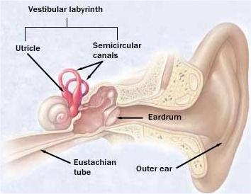 MENİERE HASTALIĞI Nedeni bilinmeyen iç kulak