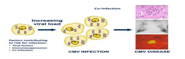 + Sitomegalovirüs (CMV) Çift sarmallı, lineer, zarflı, HHV tip 5 ailesinden CMV post-transplantasyon dönemde en önemli enfeksiyoz komplikasyon Seroprevalans %90-100 (gelişmekte olan ülkelerde),