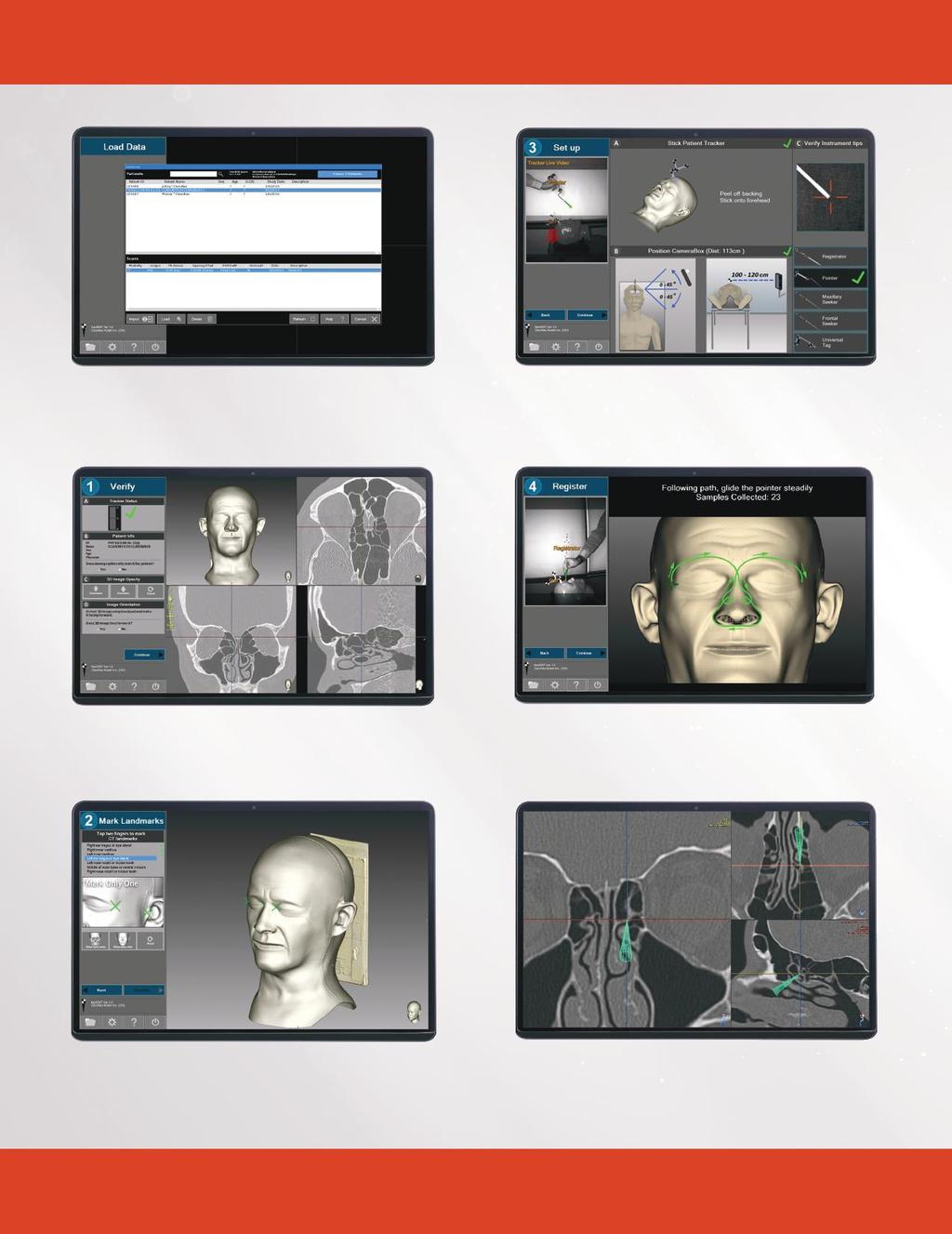 Modern Kullanıcı Arayüzü Hasta taramasını yükle İzleme kamerasını konumlandır, yeni enstrümanı kalibre et ve uç doğruluklarını doğrula Hasta bilgisini doğrula ve hasta