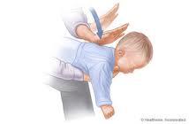 Bebeklerde Tam Tıkanıklığa İlk yardım Bebek ilk yardımcının bir kolu üzerine ters