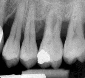 Periodontal Tedavi Planlaması Fazları İlk Faz: