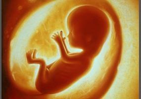 Önce anne hayatı, sonra fetus Fetusun yaşatılabilmesi 24 26 hafta 24 haftadan önce tüm resüsitatif işlemler anneye