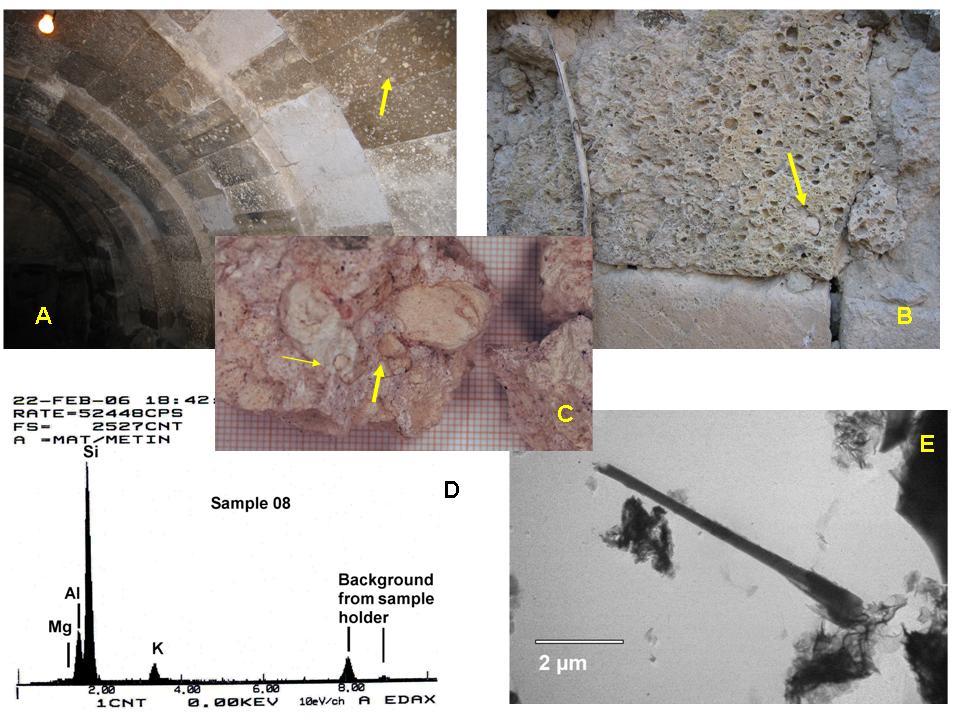 Erionite exposure and mesothelioma Stones: Örencillik Akkuşak Akköy Su kayası