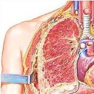 Mesothelioma Lung Chest wall Mesothelioma