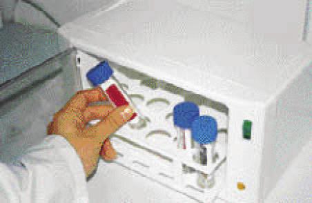 Kırmızı Coli-Count Test Kiti Mavi Yeast and Mold Test Kiti Sarı 25 m-hpc agar Toplam Canlı-Stresli