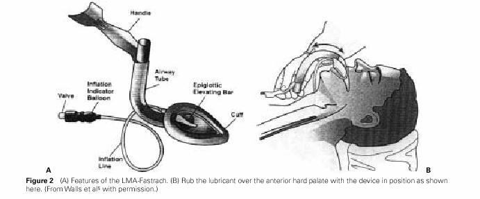 Boyun anatomisini iyi bilmek önemlidir.