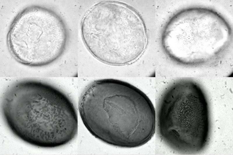 (2007) 41 a b c d e f g h i j k l m n ö Şekil 1. b. Polenlerin ışık mikroskobu fotoğrafları.