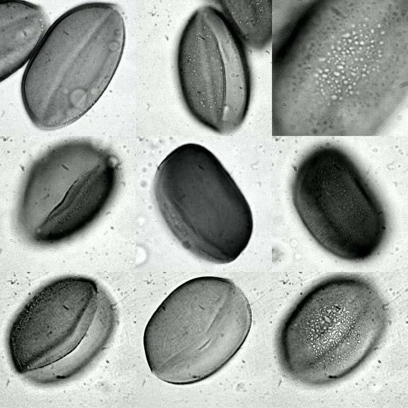 42 Erciyes Dağı nda (Kayseri) Doğal Olarak Yetişen Bazı Geofit Bitkilerin (Liliaceae, Iridaceae) Polen Morfolojisi a b c d e f g h i j k l Şekil 1. c. Polenlerin ışık mikroskobu fotoğrafları.