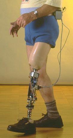 Elektronik Diz Üstü Protez Çeşitleri Yarı etkin diz üstü protezler Dizin sönümlemesini ve