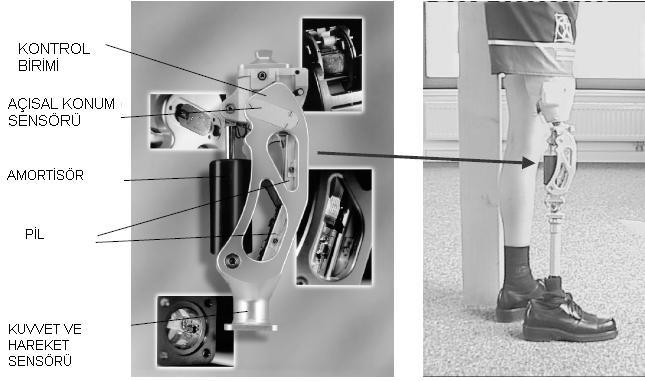 Carlson, 2001, Donanım Bu diz protezi gömülü bir düzenekten oluşmaktadır. Diz üstü protezde sönümlendirici olarak doğrusal MR sönümlendirici kullanılmaktadır.