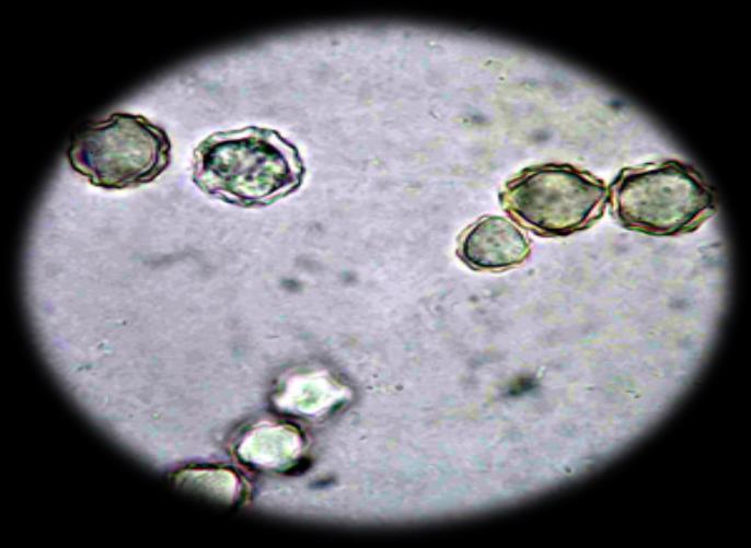 Kültür Trichomonas vaginalis Modifiye Diamond besiyeri, Cysteine-peptone-livermaltose (CPLM) besiyeri