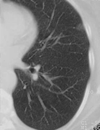 Cardinale, Radiol Med 2009; 114:871