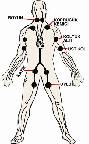 Bu tür kanamalarda asıl yapılması gereken, kanayan yer üzerine veya kanayan yere yakın olan bir üst atardamar bölgesine baskı uygulanmasıdır.