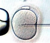 Sperm Yıkama Sperm yıkama ve PCR (10 kp/ml) sonrası: Intrauterin inseminasyon In vitro fertilizasyon Intrasitoplazmik sperm enjeksiyonu yapılabilir.