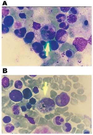 Phagocytosis of red blood cell by macrophage