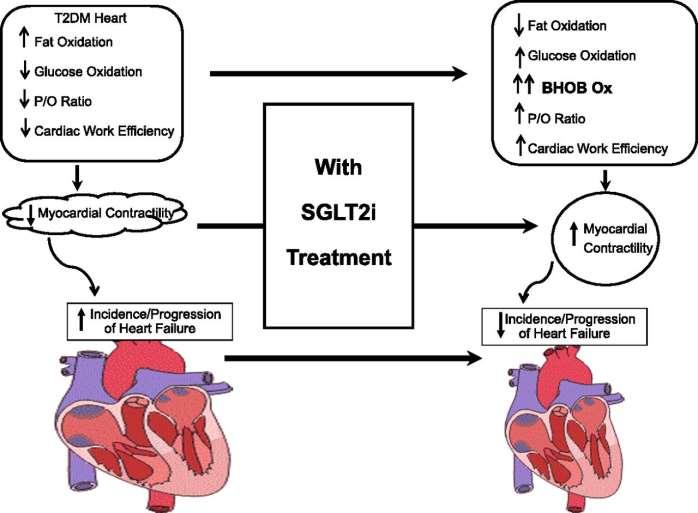 SGLT İnhibisyonu ve Myokard Yakıt Metabolizmasında Değişim Sunder