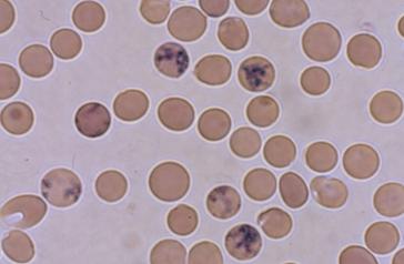 olgun eritrosit halini almaları 1 gün sürer. Normalde eritrositlerin kabaca % 1 i (% 0.5-2.0) retikülosit evresindedir.