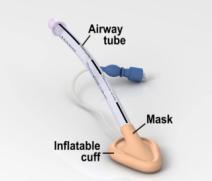 Laringeal Mask Airway LMA bir supraglottik havayolu aracıdır. Supraglottik havayolu araçları, vokal kordların üzerinde kalan kısımlar üzerinden ventilasyon sağlarlar.