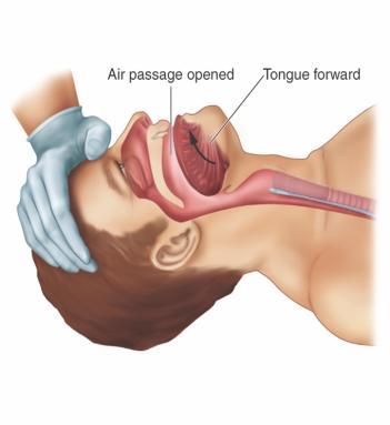 (Larinks) Alt solunum yolları; nefes borusu (Trakea), bronşlar (Bronchi) ve akciğer de dahil solunumsal bronşiollere kadar olan akciğer içi hava iletici bölümdür.