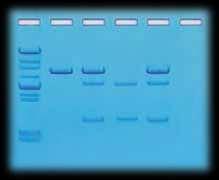 DNA ELEKTROFOREZİ Kanser genleri tesbiti Orak Hücre