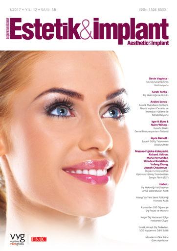 [ Ücreti: 99 TL] Estetik&İmplant Dergisi Estetik ve implant konularında, dişhekimleri için son derece öğretici bilgilerin bulunduğu