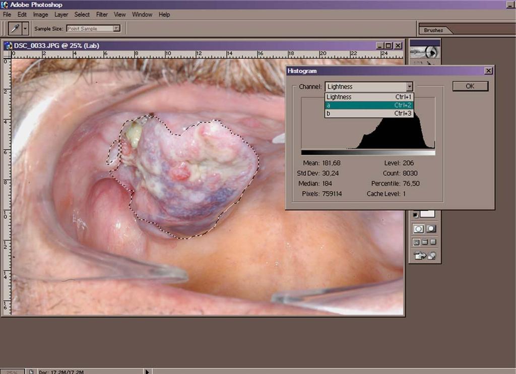 4. İşaretlenmiş alanın değerlendirilmesi amacıyla, programın histogram fonksiyon kısmı açıldı (Şekil 56).