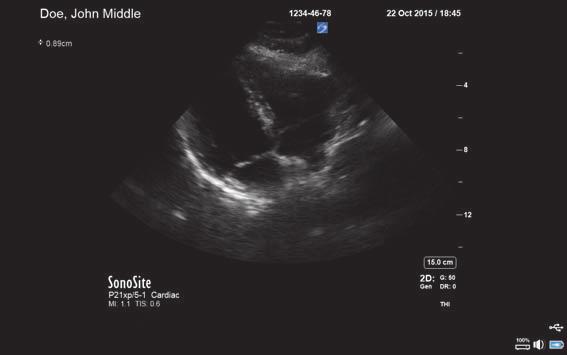 Klinik monitör ultrason resminin yanı sıra muayene ve sistem durumu hakkında ayrıntıları gösterir.
