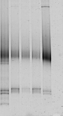 Yapılan optimizasyon çalışmaları sonucu % 3-60 denaturan konsantrasyonunun DGGE analizi için uygun olduğu görülmüş, PCR ürünleri bu denaturan konsantrasyonuna sahip jellerde yürütülmüş ve Şekil 3 de