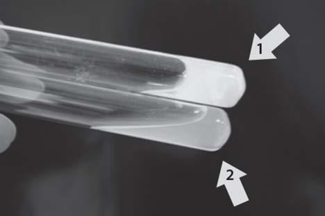 Trichosporon spp. Suşlarında Bazı Virülans Faktörlerin Araştırılması Resim 6.