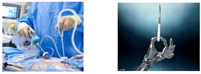 Endometriozis için Laparoskopik vs Robotik Cerrahi (LAROSE): Çok Merkezli Randomize Kontrollü Çalışma Enrique Soto, M.D., M.Sc., Thanh Ha Luu, M.D., Xiaobo Liu, M.S., Javier F. Magrina, M.D., Megan N.