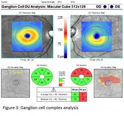 **Retinadaki ganglion hücrelerinin %50 si perimaküler bölgede lokalizedir **GCC; ganglion hücre aksonlarından, ganglion hücre