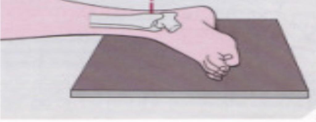 Bu görüntüleme yöntemi ile talotibial eklemin lateral ilişkisi, talusun öne veya arkaya deplasmanı, ön veya arka tibial kenar kırıkları, talus boyun kırıkları, fibulanın