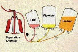 Taze donmuş plazma (TDP) 1 Ü tam kanın santrifüjasyonu veya plazmafrezle