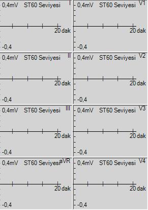 7.3.24. Averajlar / ST Trend Grafikleri Şekil 7.23 Averajlar Grafikleri Şekil 7.24 ST-seviyesi Grafikleri Şekil 7.