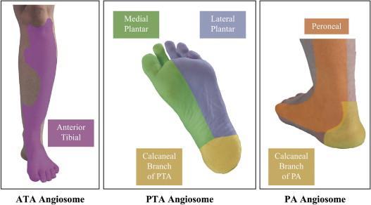 Revaskülarizasyonun amacı,ayak arterlerinden en az