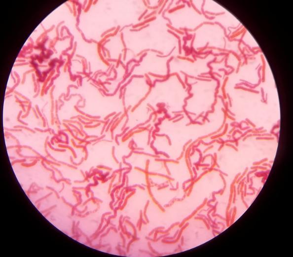 üremelerinin mikroskobik görüntüsü
