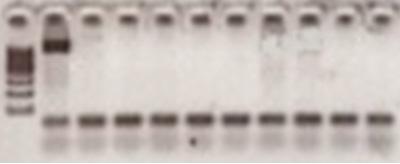 D. GÜLDEMİR Cilt 75 Sayı 2 2018 BULGULAR Laboratuvar çalışma ortamının kontrolü için laboratuvarımızda, RFLP-BGK (1), PFGE-BGK (2), NAE-BGK (3), NAE-TÜ (4), DNA SEQ-TÜ (5), Temiz Oda- PZR-1 (6),