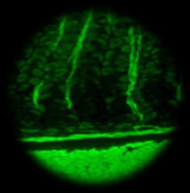 3.12.3. ASMA (Anti Smooth Muscle Antibody/Düz Kas Antikoru) Lab. Test Kodu: 300335 Çalışma Yöntemi: İndirekt immünfloresan antikor (İİFA) Örneğin Çalışma Zamanı: Hafta içi 08.00-17.