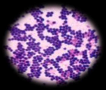 Laboratuvar Tanı Rehberlerine göre yorumlanarak raporlanır. Açıklama: Klinik örneklerde lökosit ve eritrosit hücre sayısının araştırılması esasına dayanır. Eritrosit lökosit mikroskop 3.1.1.2.