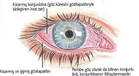 3.1.2.11. Kateter kültürü+bakteri/mantar tanımlanması ve duyarlılık testi Lab.