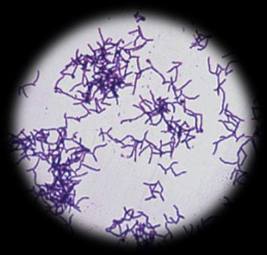 3.1.4. SPESİFİK KÜLTÜR 3.1.4.1. Actinomyces kültürü+bakteri tanımlanması Lab.