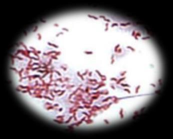 3.1.4.3. Campylobacter kültürü+bakteri tanımlanması Lab.