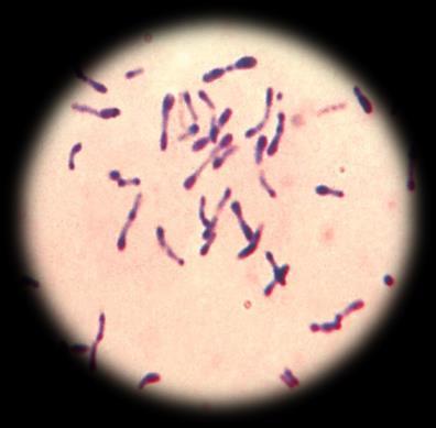 3.1.4.5. Difteri kültürü+bakteri tanımlanması Lab.