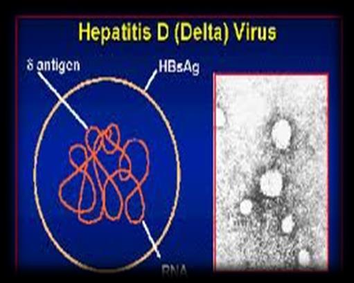 3.5.11. HDV Ag (Hepatit D Virüs Antijeni) Lab.
