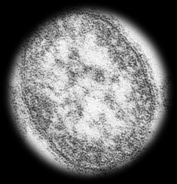 3.5.21. Measles (Kızamık) IgG Lab. Test Kodu: 300184 Çalışma Yöntemi: ELISA (Enzyme Linked İmmun Sorbent Assay) Örneğin Çalışma Zamanı: Hafta içi 08.00-17.