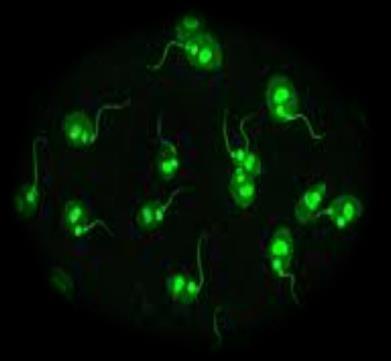 12.2. ds DNA (Anti Double Stranded DNA/nDNA) Lab. Test Kodu: 300341 Çalışma Yöntemi: İndirekt immünfloresan antikor (İİFA) Örneğin Çalışma Zamanı: Hafta içi 08.00-17.