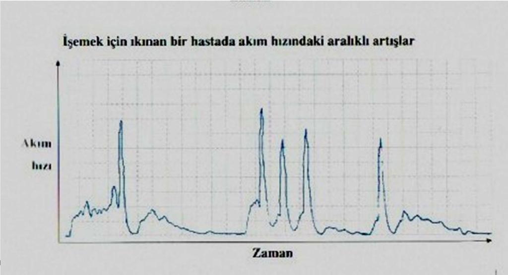 İşeme mi yoksa ıkınma