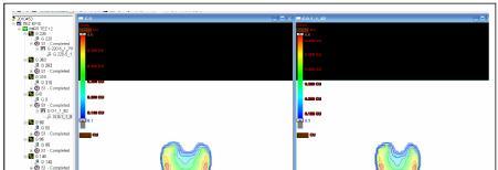 Şekil 31: Eclipse Portal Dozimetri yazılımı ile değerlendirme. DD (%3) ve DTA (3 mm) kriterlerine göre gamma indeksinde değerlendirme yapıldı.