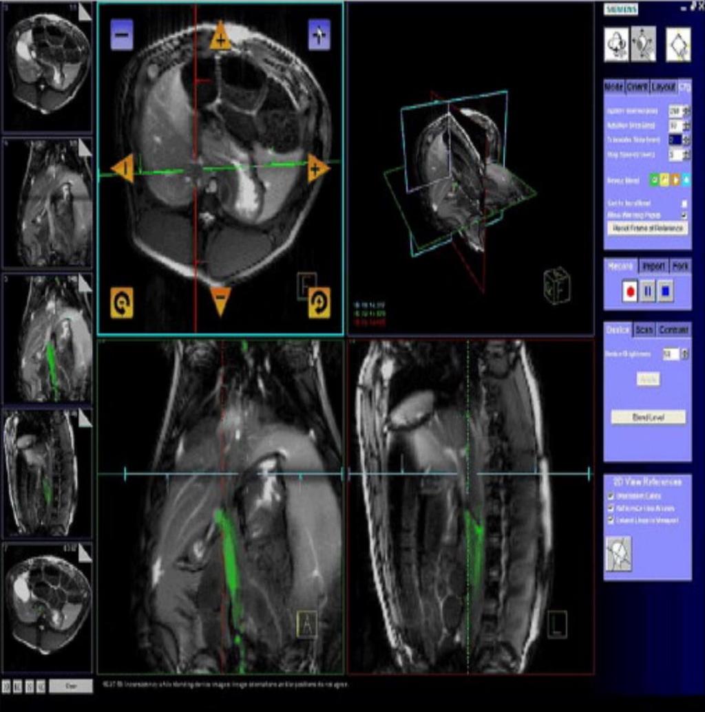 Girişimsel MRG için Medikal Cihaz Teknolojileri Medikal Cihazlar MRG altında görüntülenebilir olmalıdır.
